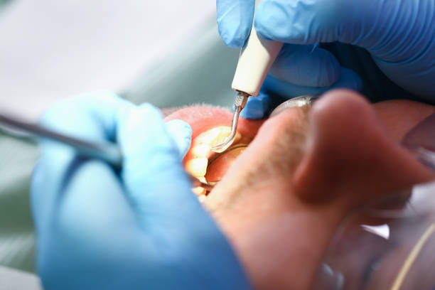 Best Pediatric Emergency Dentist in Riverside, UT